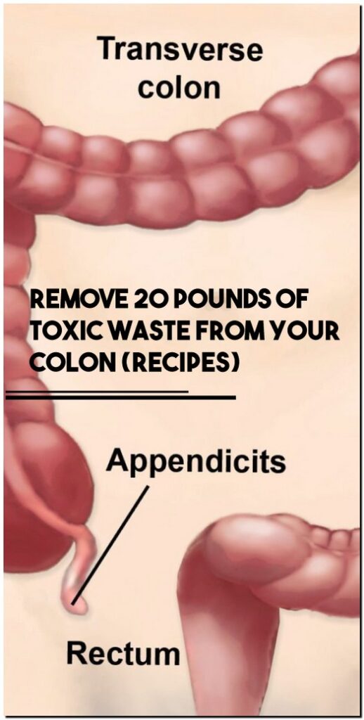 Remove 20 Pounds Of Toxic Waste From Your Colon (Recipes)