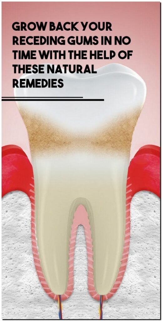 Grow Back Your Receding Gums in no Time With The Help of These Natural Remedies