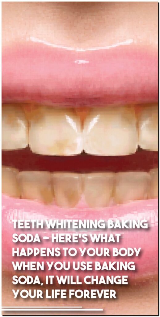 Teeth Whitening Baking Soda – Here’s What Happens To Your Body When You Use Baking Soda It Will Change Your Life Forever